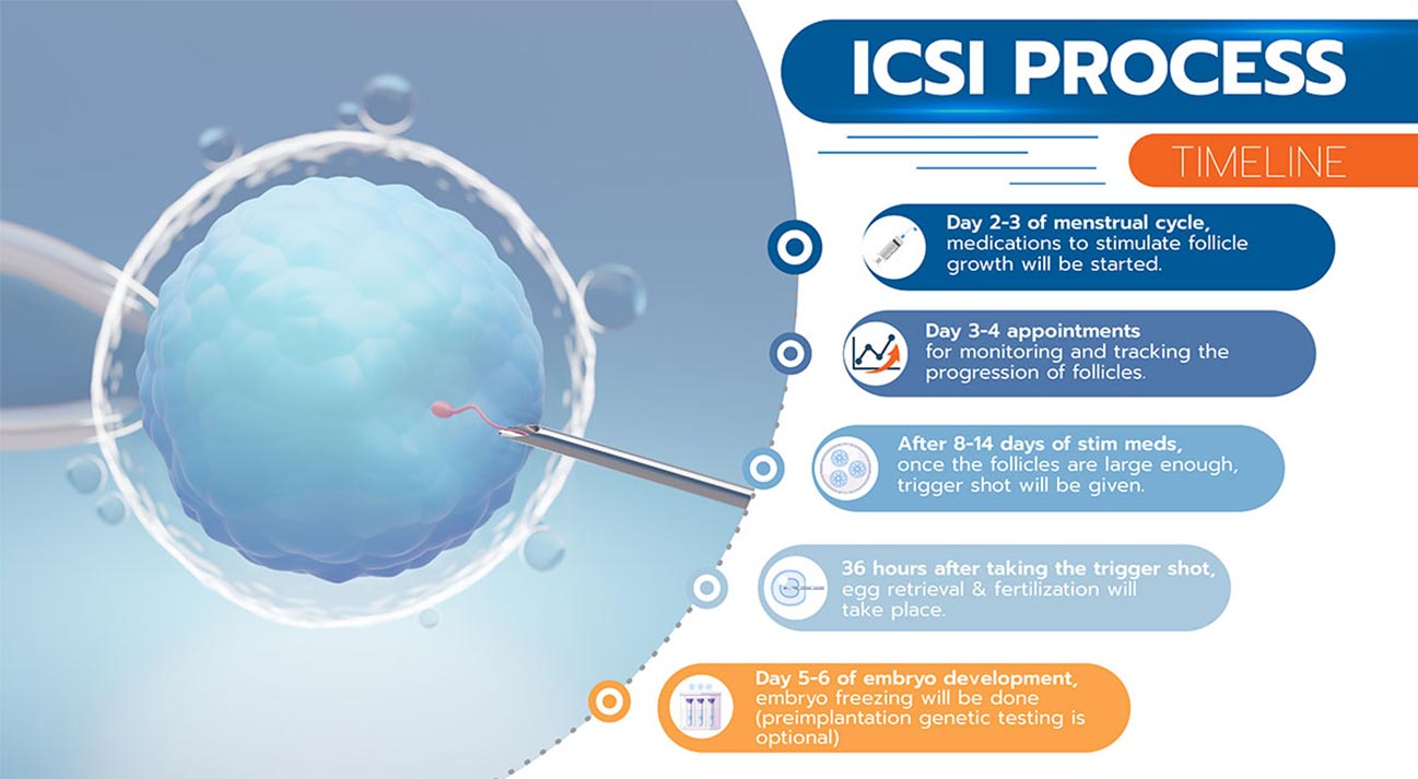 ICSI Process timeline