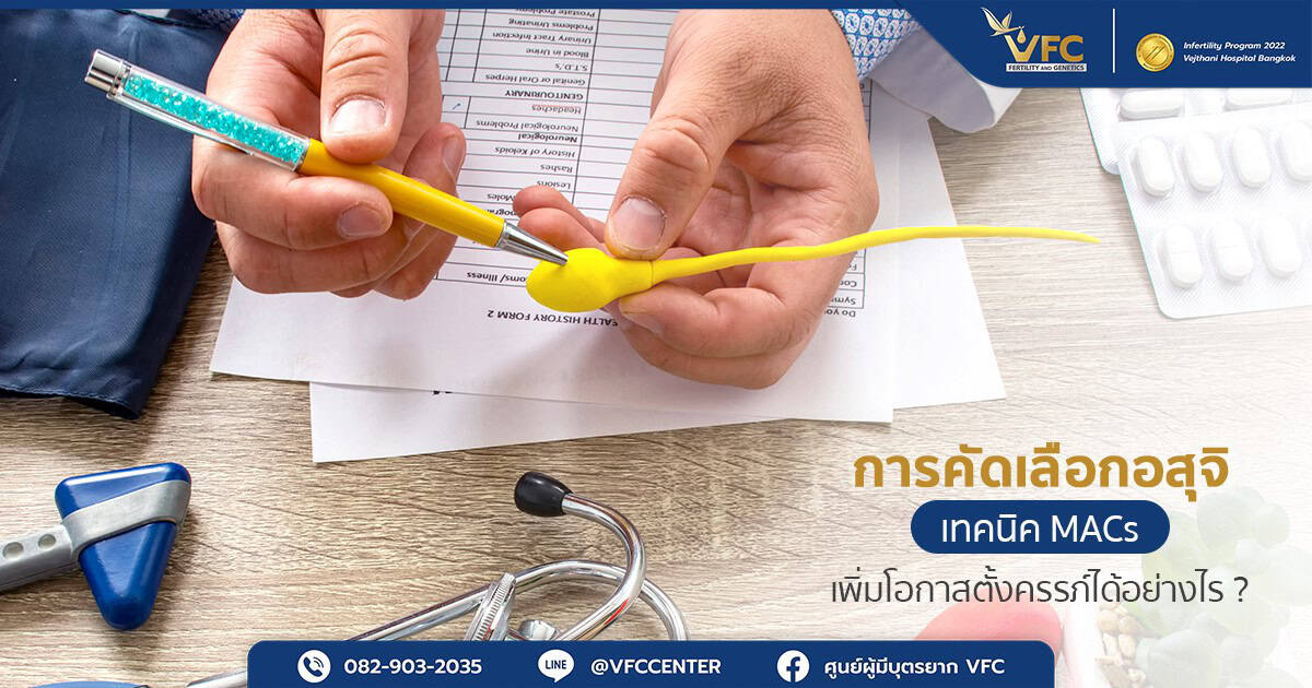 แพทย์อธิบายให้ผู้ชายฟังว่าเทคนิค MACs Sperm คืออะไร มีความสำคัญอย่างไร