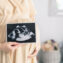 A pregnant woman holding an ultrasound result