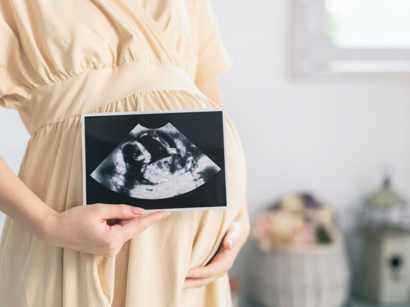 A pregnant woman holding an ultrasound result