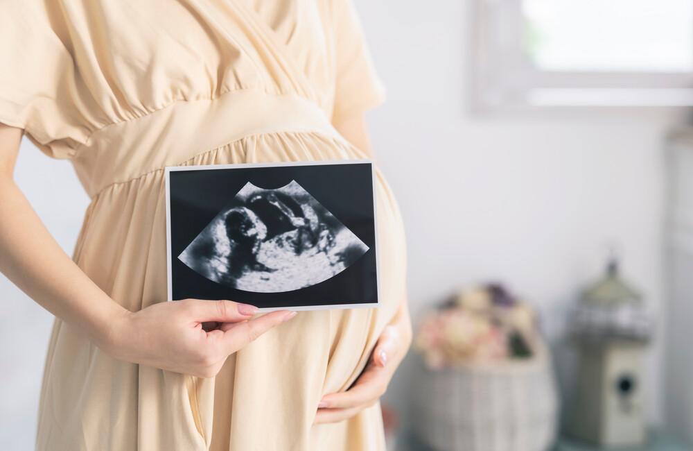 A pregnant woman holding an ultrasound result