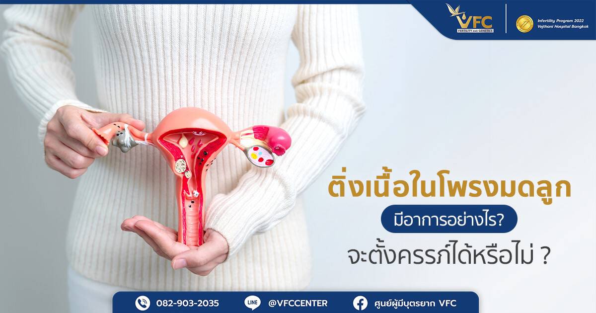 ผู้หญิงมีอาการติ่งเนื้อในเยื่อบุโพรงมดลูก สามารถตั้งครรภ์ได้หรือไม่ ?