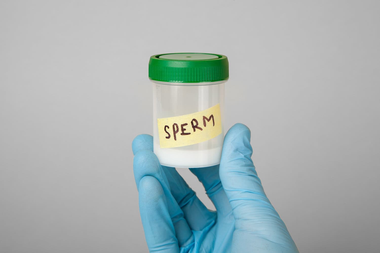 A sample of the color of healthy sperm.