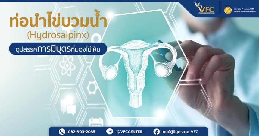 ท่อนำไข่บวมน้ำ (Hydrosalpinx) คือภาวะที่ท่อนำไข่อุดตันและบวมพองเพราะมีของเหลวใสสะสมอยู่ภายใน