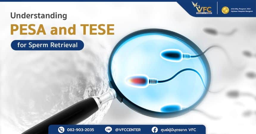 Sperm collection and selection of healthy sperm for IVF