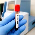 hpv-health-screening-before-pregnancy-planning2 ารตรวจเชื้อ HPV เป็นหนึ่งในรายการตรวจสุขภาพที่ควรตรวจเมื่อวางแผนตั้งครรภ์