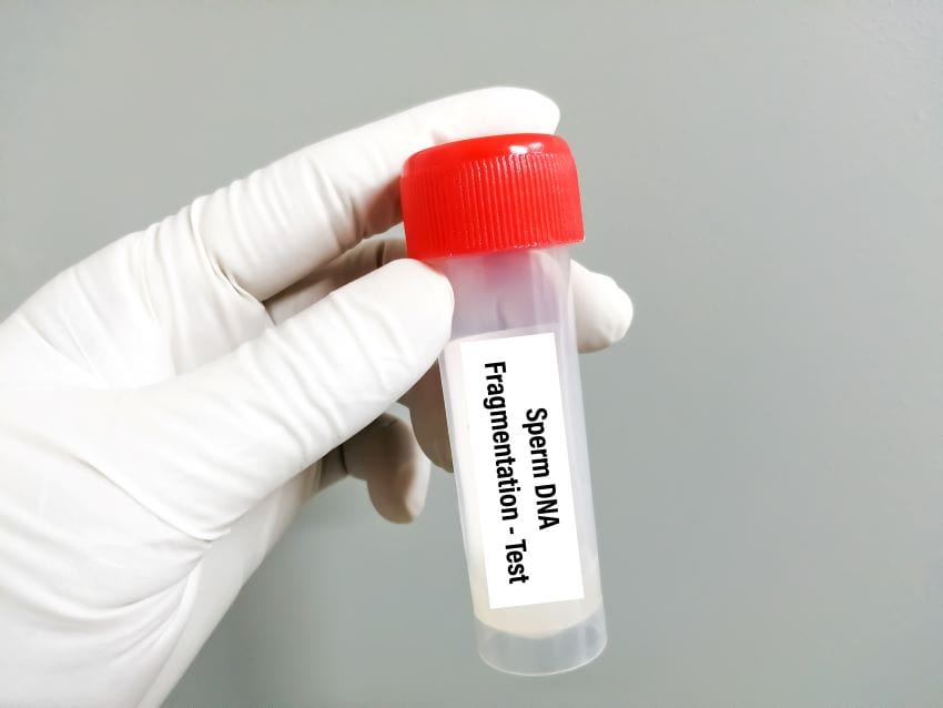Sample container for sperm collection to test for DNA fragmentation