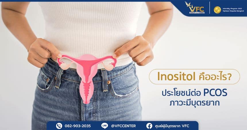 ผู้หญิงที่มีภาวะ PCOS ที่ต้องการสาร Inositol สำหรับปรับสมดุลฮอร์โมน