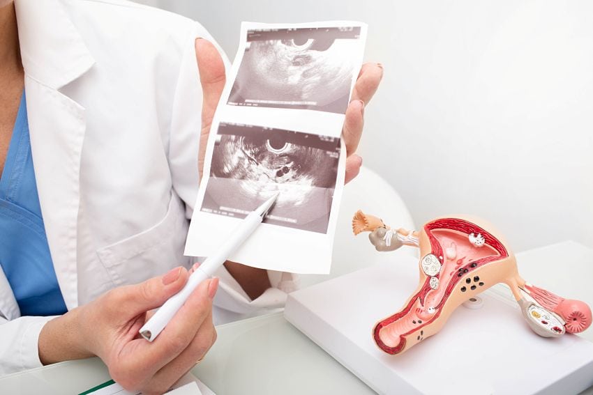 a doctor explaining the results of a transvaginal ultrasound