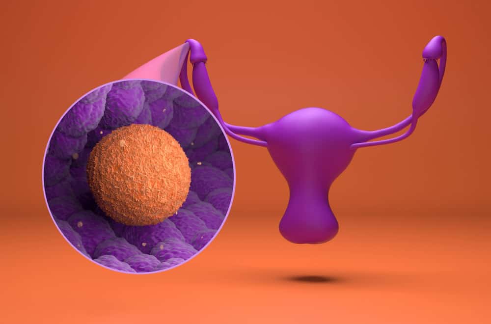 Ovarian oocyte model showing immature oocyte condition before OMM treatment